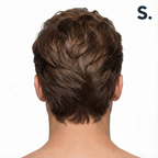 Scalp Pack | Equilibrio + Fuerza